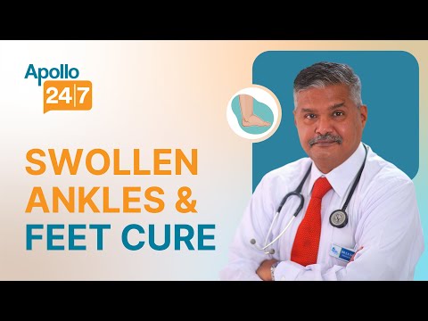 Is Wearing Heels Harmful For Joints Dr Manabendra Nath Basu Mallick