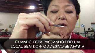 ACUPUNTURA ALÉM AGULHAS - 5