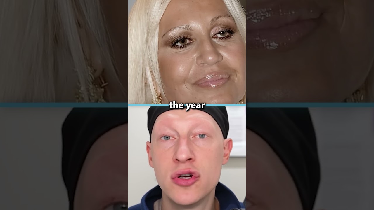 Donatella Versace's NEW FACE | Plastic Surgeon Reacts