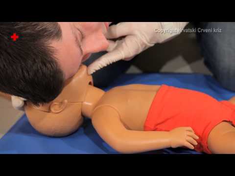 Bewusstlosigkeit – Säugling