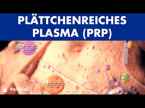 Plättchenreiches Plasma (PRP) ©