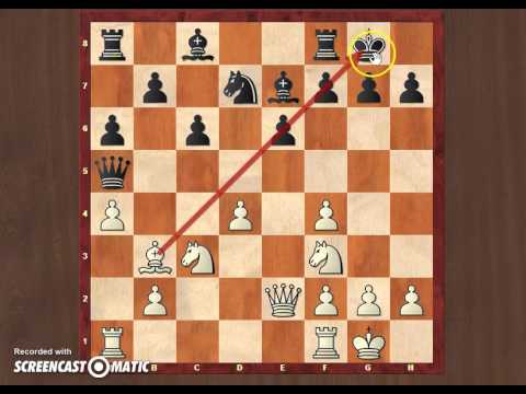 The Fall of a Titan! Don't worry, he will return stronger! Wojtaszek- Granda Zuniga