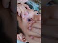 Aletha Kebanyakan Kasih Obat Ke Papoy Alethaabew
