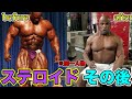 ステロイドの副作用を受けた人たち【筋トレ】