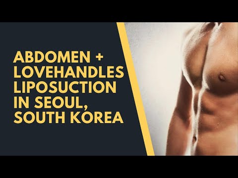Most Affordable Abdomen and Lovehandles Liposuction Package in Seoul, South Korea