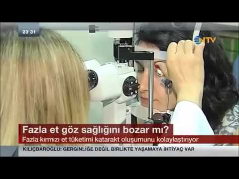 Prof. Dr. Tuğrul Akın – NTV Haber – Katarakt Tedavisi