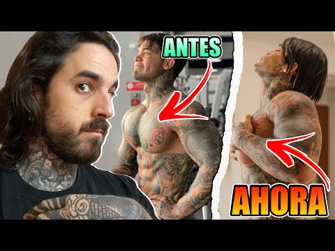YEFERSON COSSIO se PONE BUBIS de SILICONA tras una APUESTA