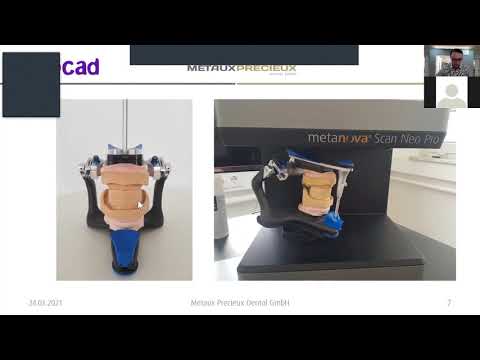 Totalprothese digital exocad Galway