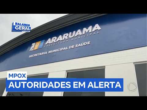 Araruama (RJ) registra primeiro caso de Mpox no interior do Rio