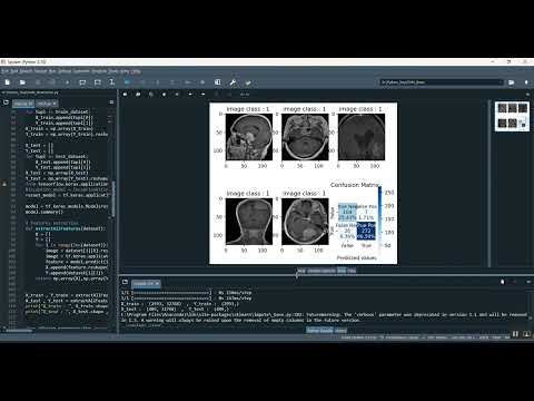 Multi Source Detection Using Brain in Python Projects
