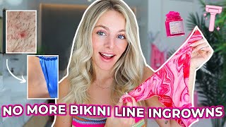 The TRUTH About How I Cleared My Dark Bikini Line | Truly Beauty!
