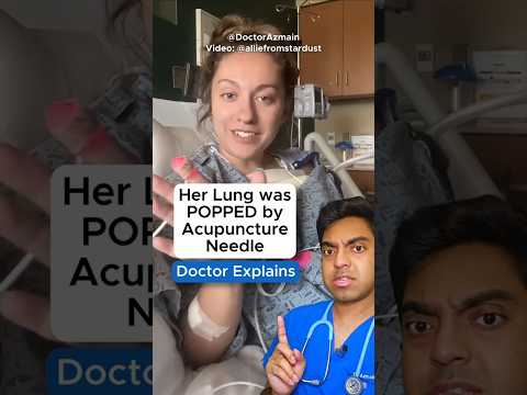 🫁💥 Her Lung was POPPED by Acupuncture Needle?! Doctor Explains Pneumothorax / Lung Collapse
