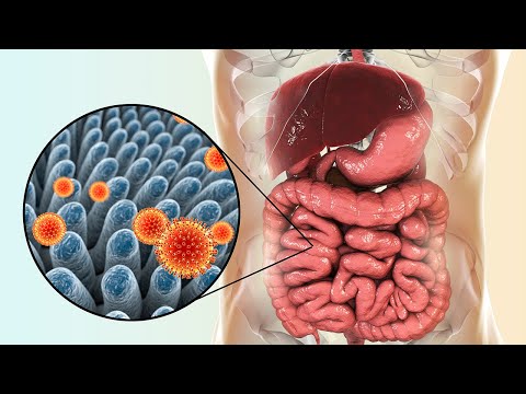 Want to be healthy? Start with your gut!