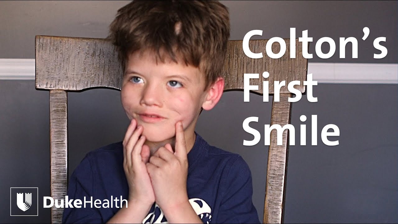 Boy with Moebius Syndrome Smiles for the First Time | Duke Health