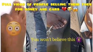 Full video of a man selling his toe | Zimbabwe | people are selling toes for money