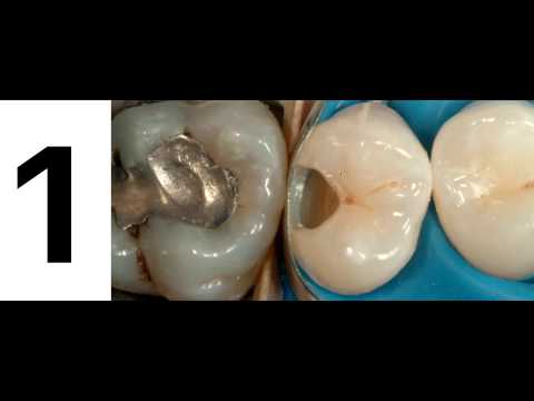 Συγκόλληση σε σκληρούς οδοντικούς ιστούς (Dental TTT - Webinar No 4).