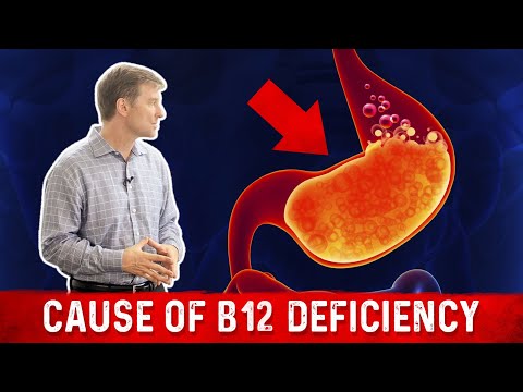 Vitamin B12 Deficiency: The most common Cause – Dr. Berg