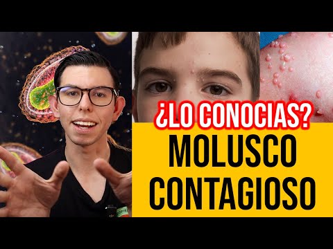 MOLUSCO QUE!! (Todo sobre MOLUSCO CONTAGIOSO) | DrPoloGuerrero
