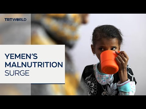 تحذير من الجوع المهدد لحياة الأطفال في اليمن