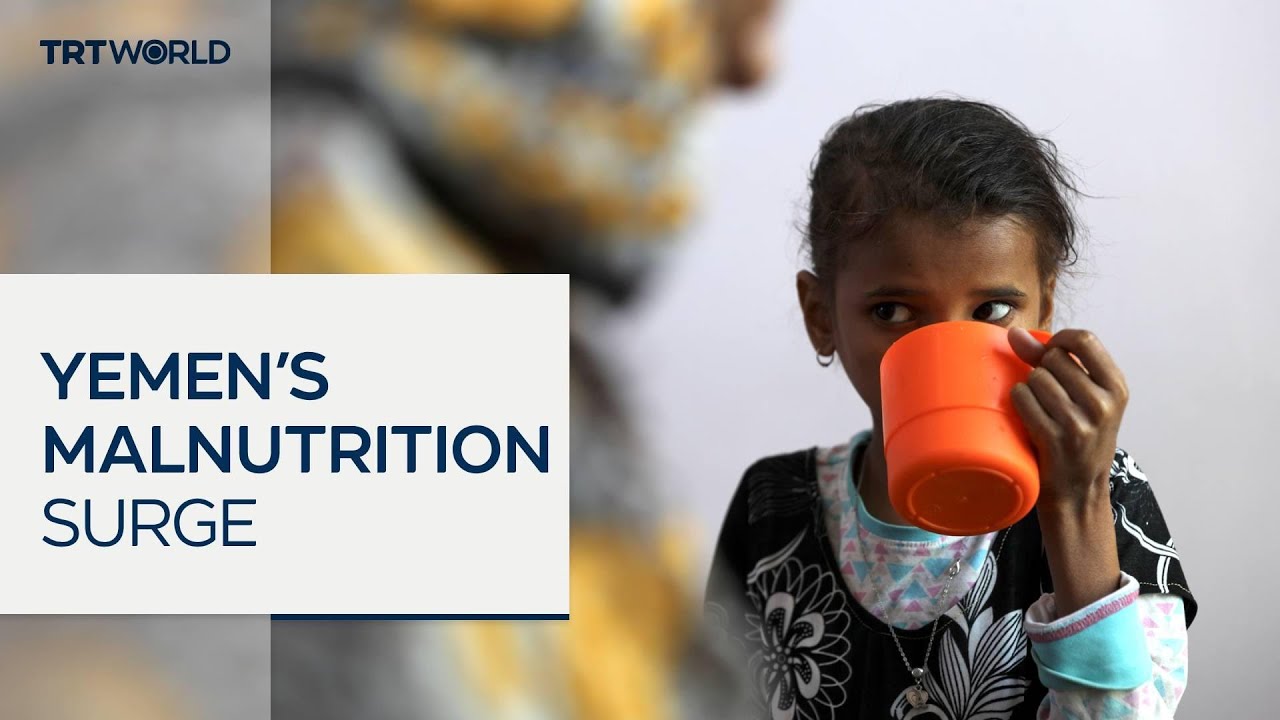 UNICEF warns of life-threatening hunger for Yemen’s youngest