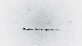 Massive myomatosis (Laparo/Hysteroscopic surgery)