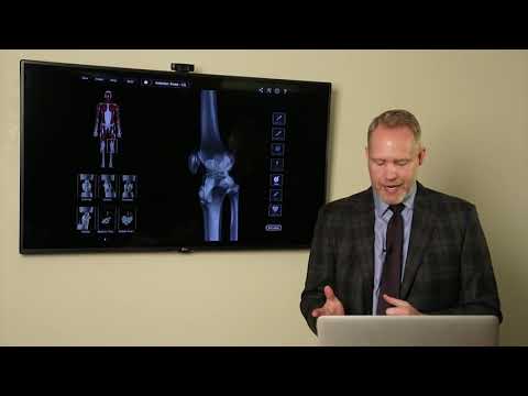 Posterior Cruciate Ligament (PCL) Injuries