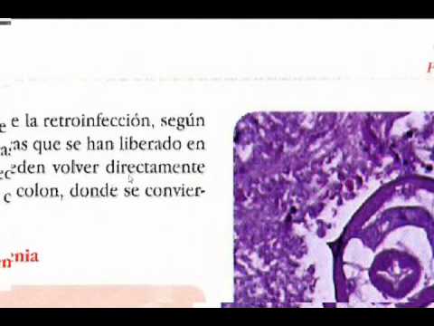 parazita giardia lamblia