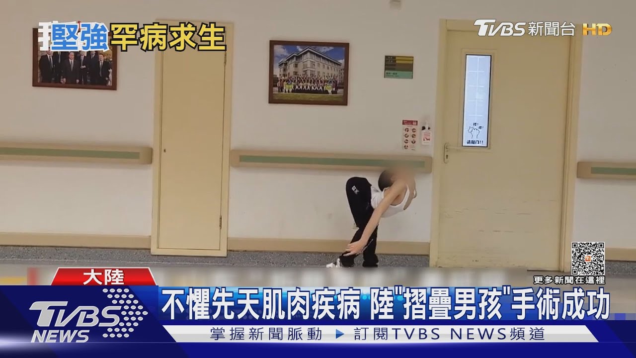 不懼先天肌肉疾病　陸「摺疊男孩」手術成功