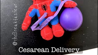 Playdough Surgery 🔪🤰🏻- Cesarean Delivery