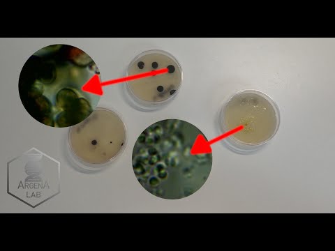 Bakterien sichtbar machen | DIY-Biologie