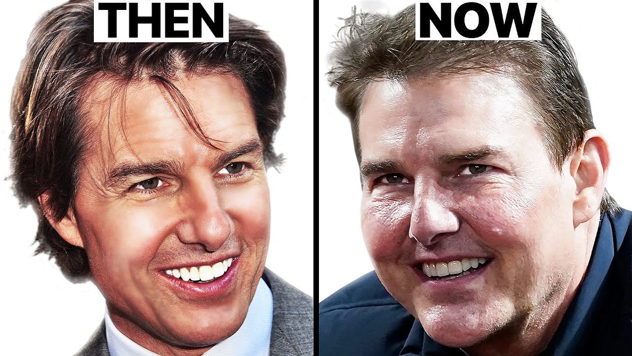 Tom Cruise: Why His Face Looks Different | Plastic Surgery Analysis