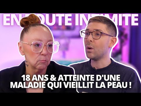 À 18 ANS, sa MALADIE RARE VIEILLIT son visage : : L’incroyable histoire d’Amélie !