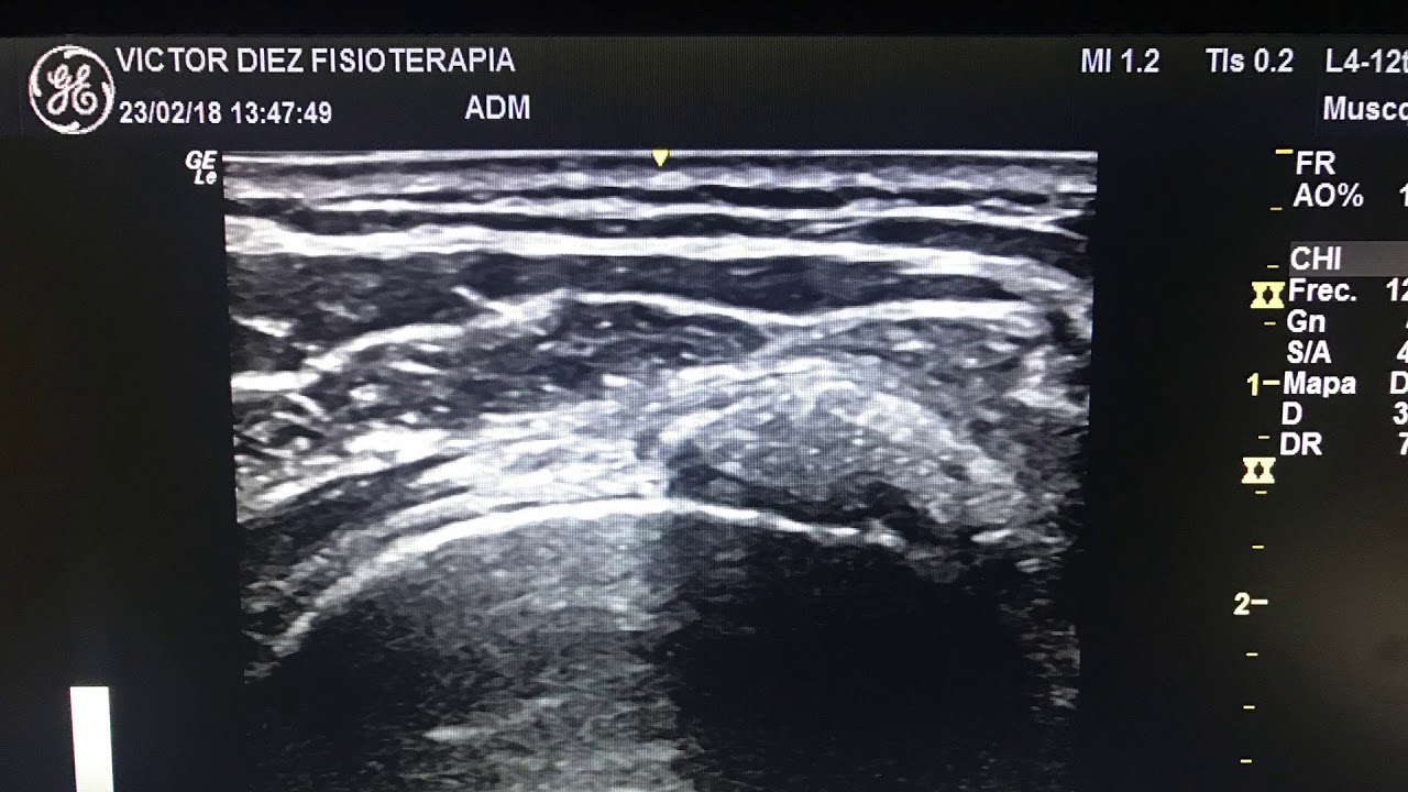 Víctor Díez Alvarez-12