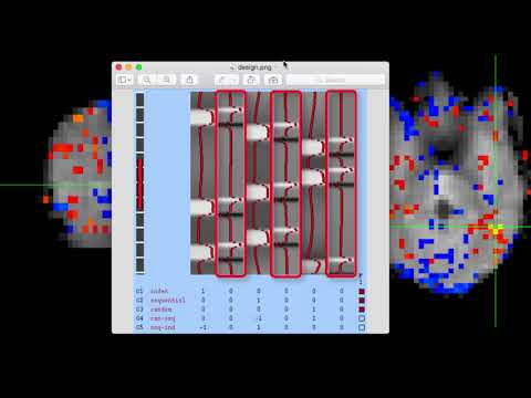 Using FSLeyes, Part 3: FEAT Mode