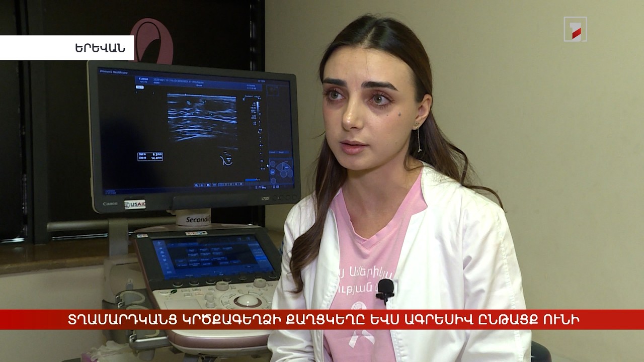 Տղամարդկանց կրծքագեղձի քաղցկեղը ևս ագրեսիվ ընթացք ունի