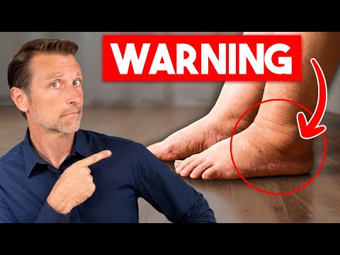 Dr. Eric Berg DC and Dr. Berg Shorts