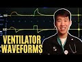 Ventilator Waveforms Troubleshooting Made Easy