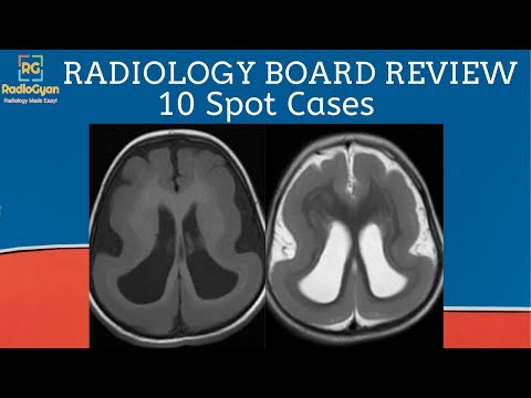 Radiology Board Core Exam Review Cases [Quiz and Discussion] | Set 10 | Sep 2020