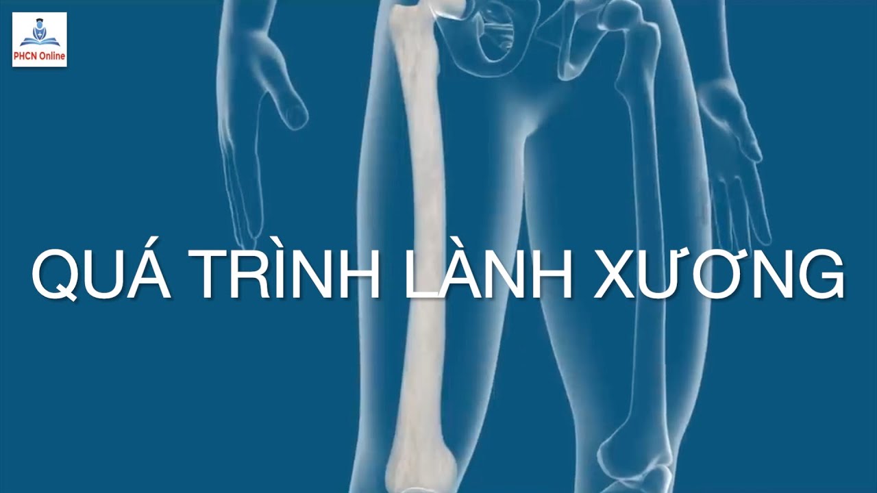 Quá trình lành xương