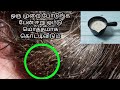 முடியில் ஒட்டி இருக்கிற ஈறு பேன் ஒட்�