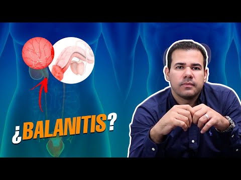 Cómo saber si se tiene BALANITIS