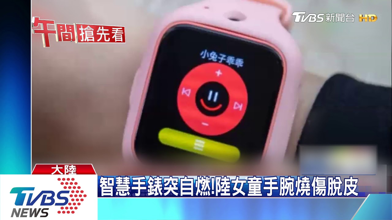 智慧手錶突自燃! 陸女童手腕燒傷脫皮