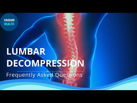 Lumbar Decompression - Frequently Asked Questions