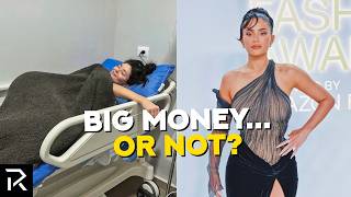 Kylie Jenner’s Stem Cell Treatment Might Cost Less Than One Instagram Post