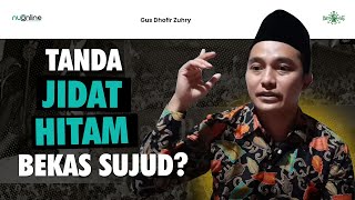Download lagu Apakah Tanda Jidat Hitam itu Bekas Sujud? | Gus Dhofir Zuhry mp3