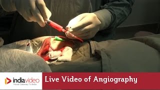 Angiography - a Medical Imaging Technique 