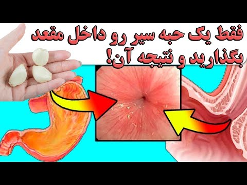 فقط یک حبه سیر رو داخل آن بگذارید و نتیجه آن!