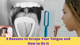 5 Reasons to Scrape Your Tongue and How to Do It