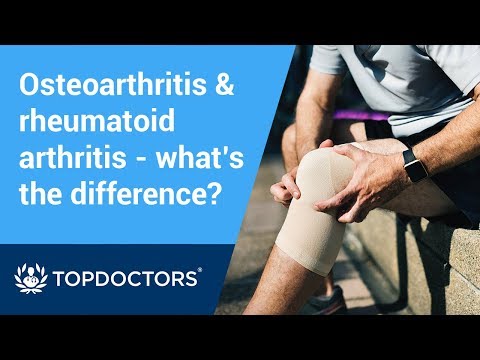 hogyan kezeljük a térd artritisz véleménye ízületi diszlokáció fájdalma