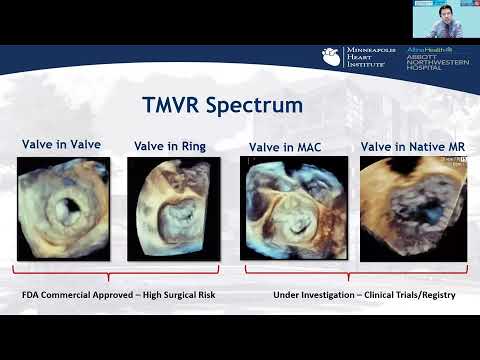 Attend TMVR Workshop on July 20